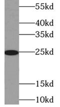 TK1 Antibody