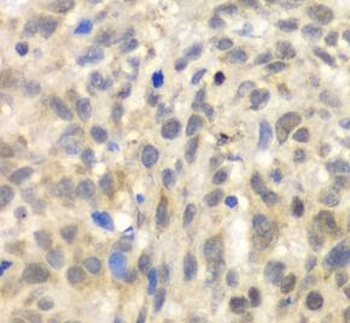 TLK2 Rabbit Polyclonal Antibody