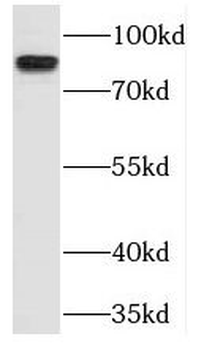 TLR5 Rabbit Polyclonal Antibody
