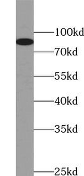 TMC1 Antibody