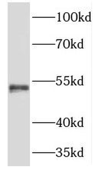 TMCO6 Rabbit Polyclonal Antibody