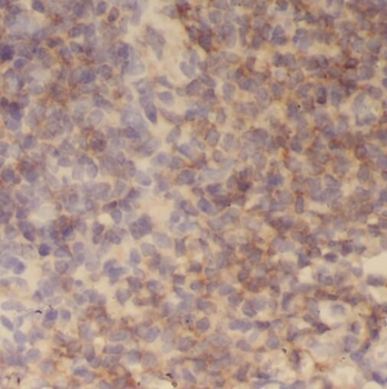 TMCO6 Rabbit Polyclonal Antibody