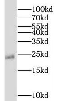 TMED2 Rabbit Polyclonal Antibody