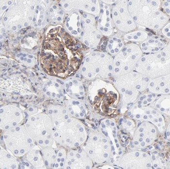 TMEM120B Rabbit Polyclonal Antibody