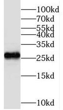 TMEM139 Rabbit Polyclonal Antibody