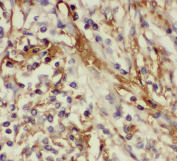 TMEM139 Rabbit Polyclonal Antibody