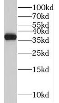 TMEM165 Antibody