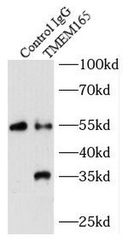 TMEM165 Rabbit Polyclonal Antibody