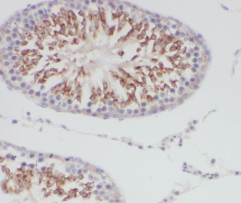 TMEM168 Rabbit Polyclonal Antibody