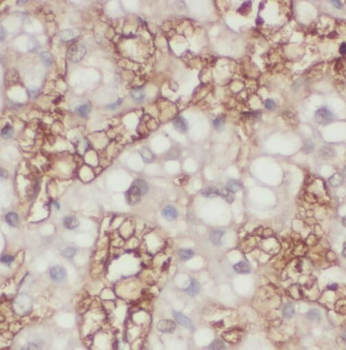 TMEM182 Rabbit Polyclonal Antibody