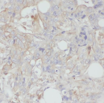 TMEM190 Antibody