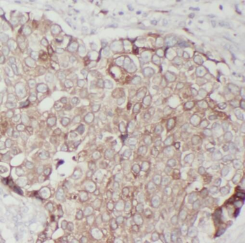 TMEM199 Rabbit Polyclonal Antibody