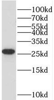 TMEM208 Antibody