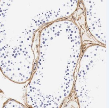 TMEM213 Antibody