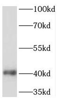 TMEM25 Rabbit Polyclonal Antibody