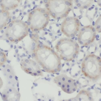 TMEM38B Rabbit Polyclonal Antibody