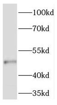 RXYLT1 Rabbit Polyclonal Antibody