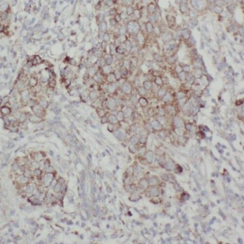 TMEM59 Rabbit Polyclonal Antibody