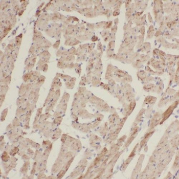 TMEM70 Rabbit Polyclonal Antibody