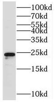 TMEM98 Antibody