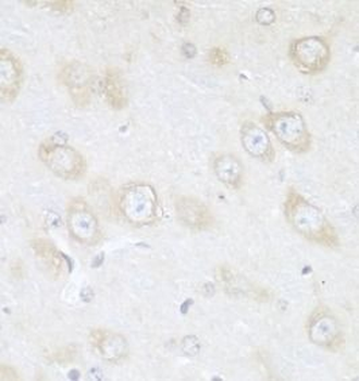 TMOD3 Rabbit Polyclonal Antibody