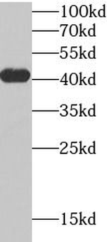 TMOD4 Rabbit Polyclonal Antibody