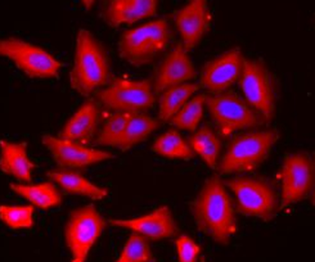 TMOD4 Rabbit Polyclonal Antibody