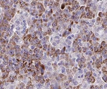 TMOD4 Rabbit Polyclonal Antibody