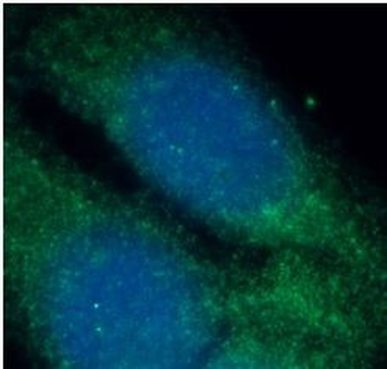 TMX4 Rabbit Polyclonal Antibody