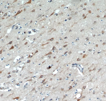 TMX4 Rabbit Polyclonal Antibody