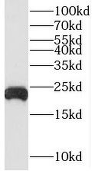 TNFAIP8 Rabbit Polyclonal Antibody