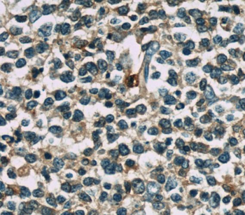 TNFAIP8 Rabbit Polyclonal Antibody