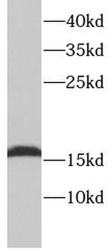 TNNC1 Rabbit Polyclonal Antibody