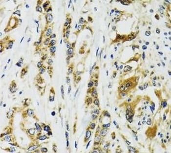 TNNC1 Rabbit Polyclonal Antibody