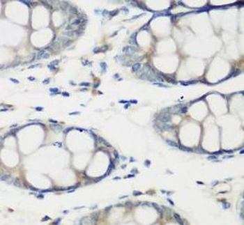 TNNC2 Rabbit Polyclonal Antibody