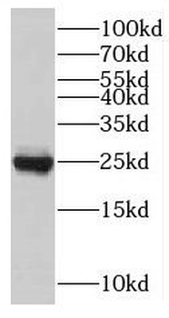 TNNI1 Antibody