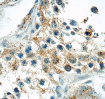 CELF3 Rabbit Polyclonal Antibody