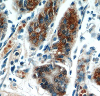 TOB1 Rabbit Polyclonal Antibody