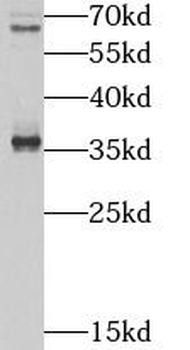 TOB2 Rabbit Polyclonal Antibody
