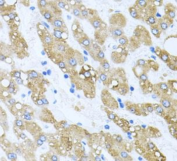 TOB2 Rabbit Polyclonal Antibody