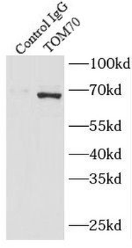 TOMM70 Rabbit Polyclonal Antibody