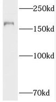 TOP2A Rabbit Polyclonal Antibody