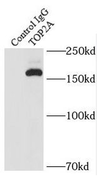 TOP2A Rabbit Polyclonal Antibody