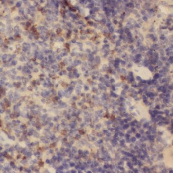 TOP2A Rabbit Polyclonal Antibody