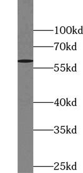TOR1AIP2 Rabbit Polyclonal Antibody