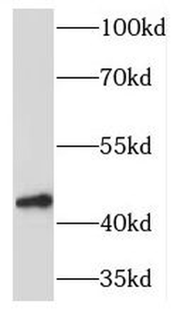 TOR1A Antibody