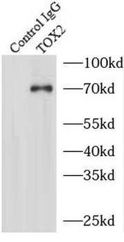 TOX2 Rabbit Polyclonal Antibody