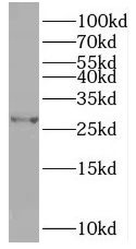 TPK1 Antibody