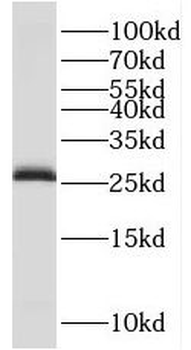 TPPP Rabbit Polyclonal Antibody