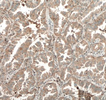 TPSD1 Rabbit Polyclonal Antibody